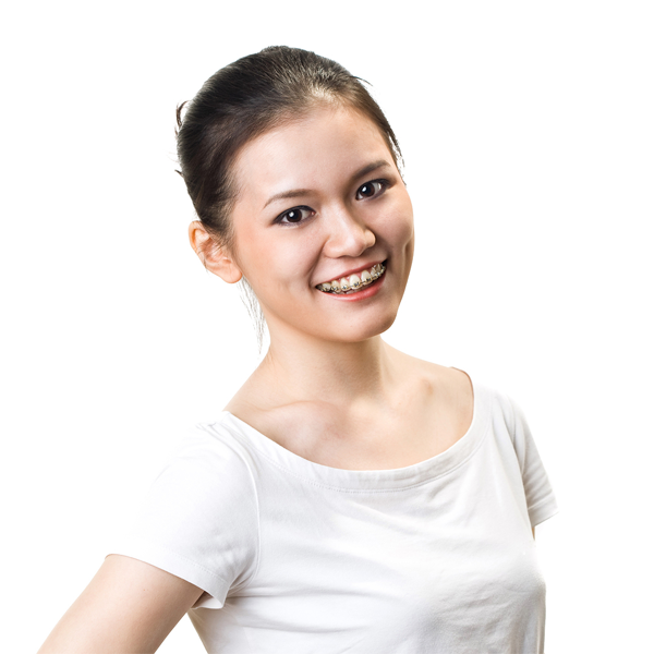 Do I Need Braces? Braces Sterling Heights MI Petrous Ortho